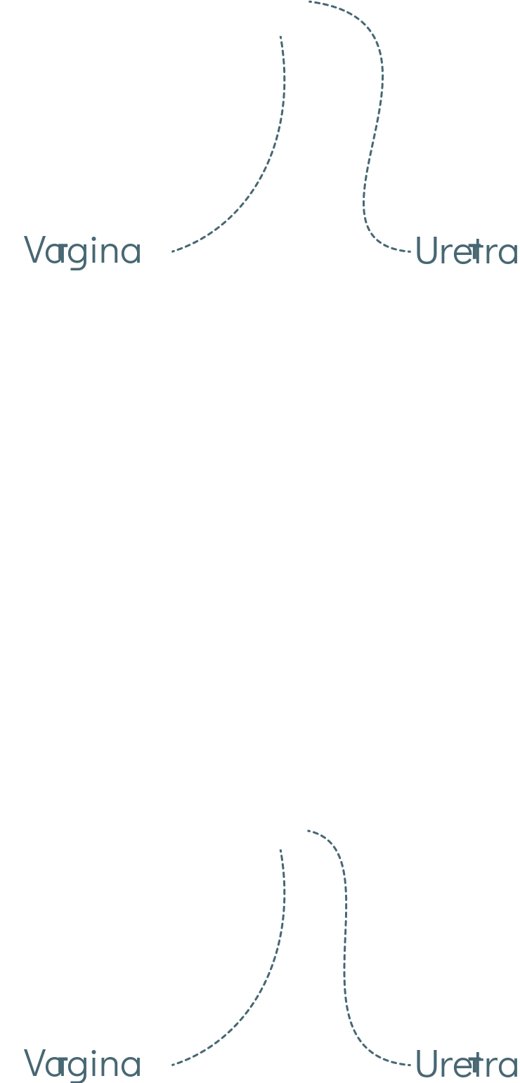labels